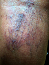 Image veines perlées