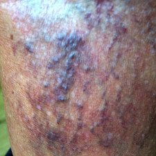 Image veines perlées